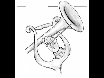 Affiche de « Examens instrumentaux »